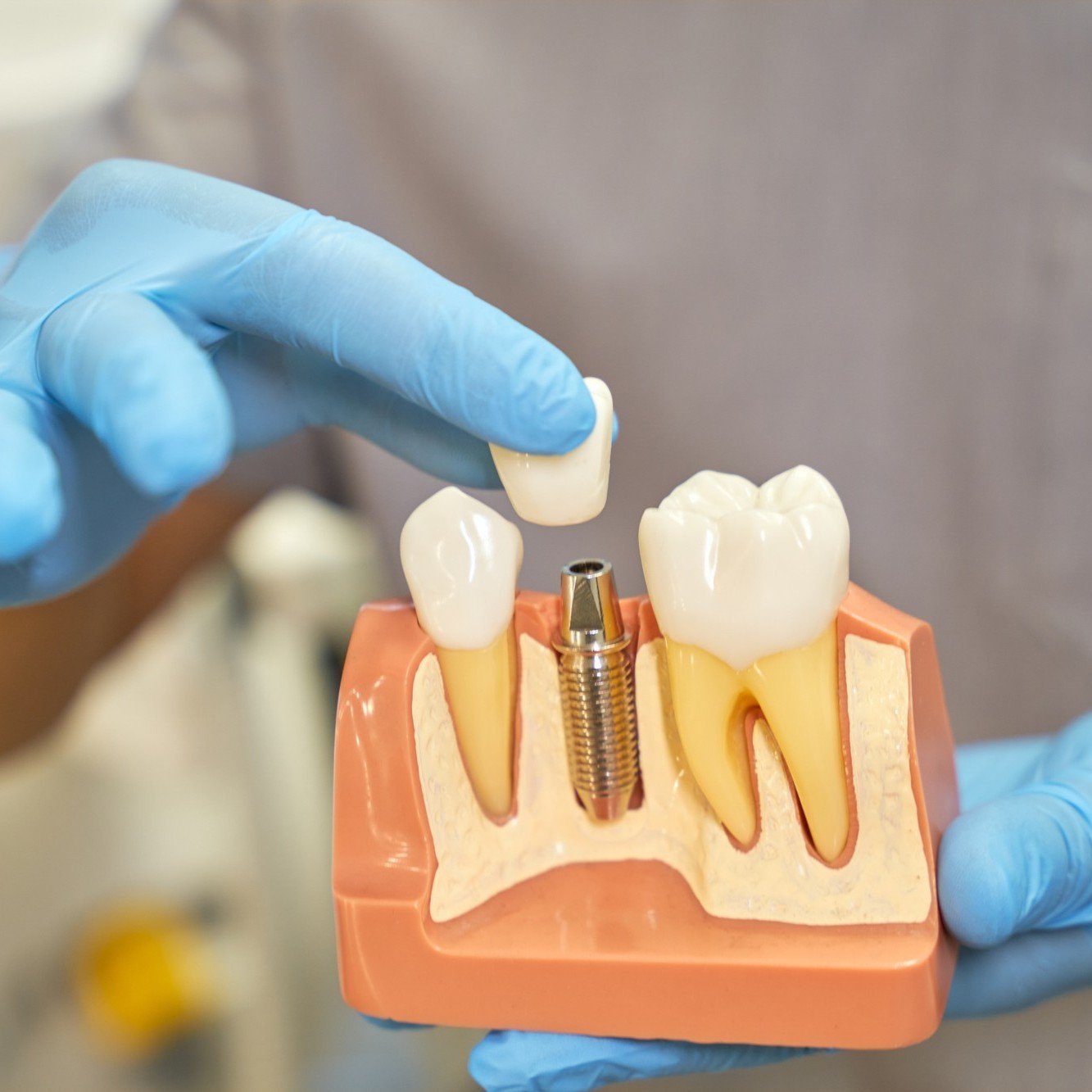 Post Extraction Care Hackettstown NJ Post Extraction Care Hackettstown NJ