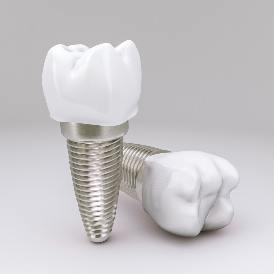Dental Implant, Hackettstown, NJ
