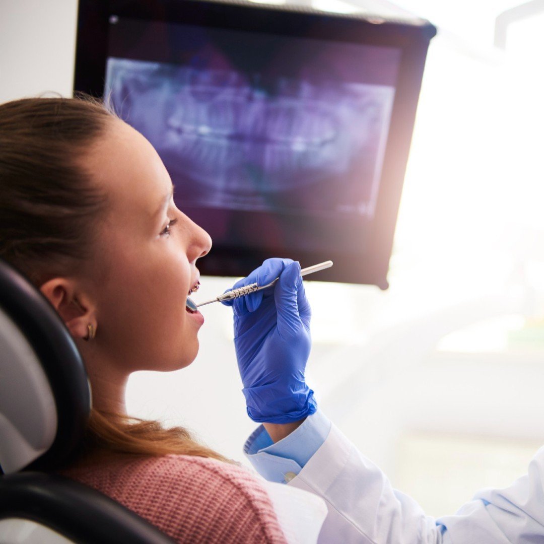 CT Scan - Dentist - NJ Panoramic dental x-ray image showing full mouth structure