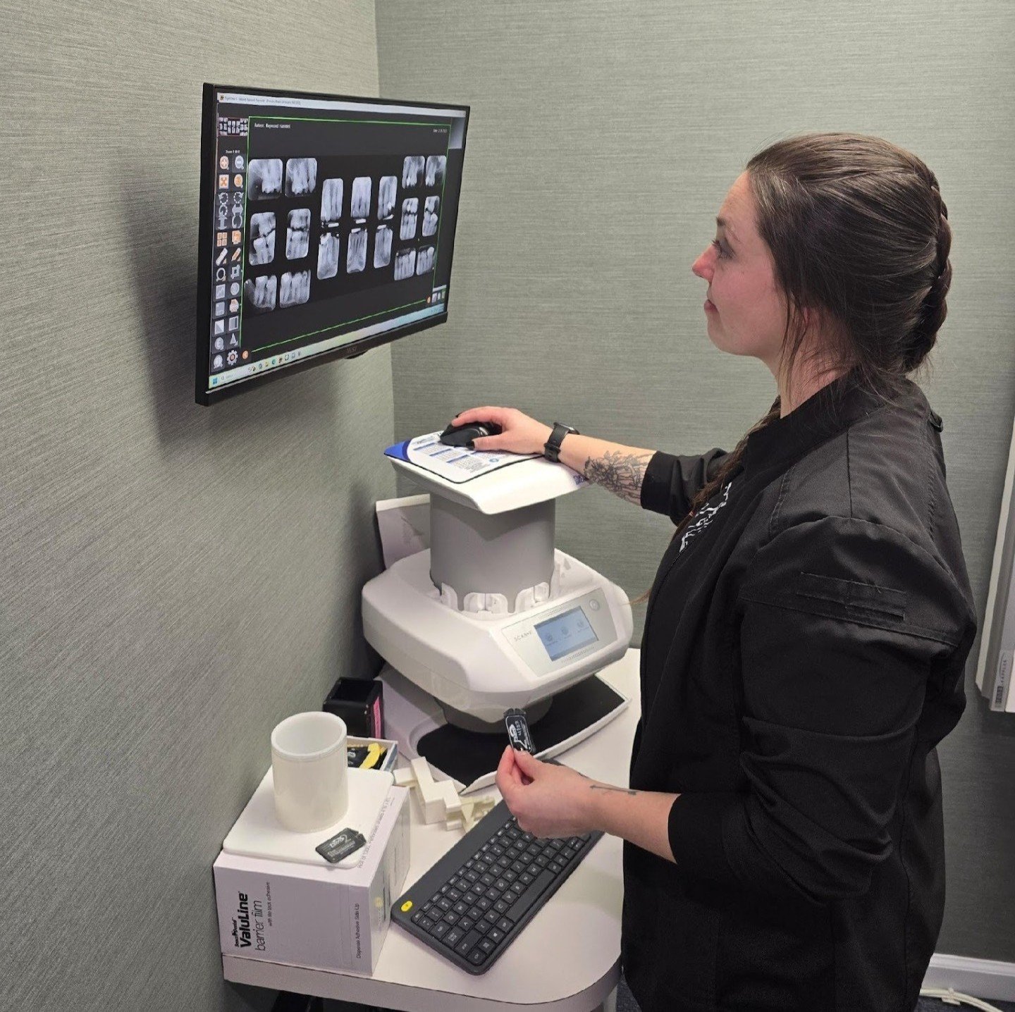 Digital X-rays in action