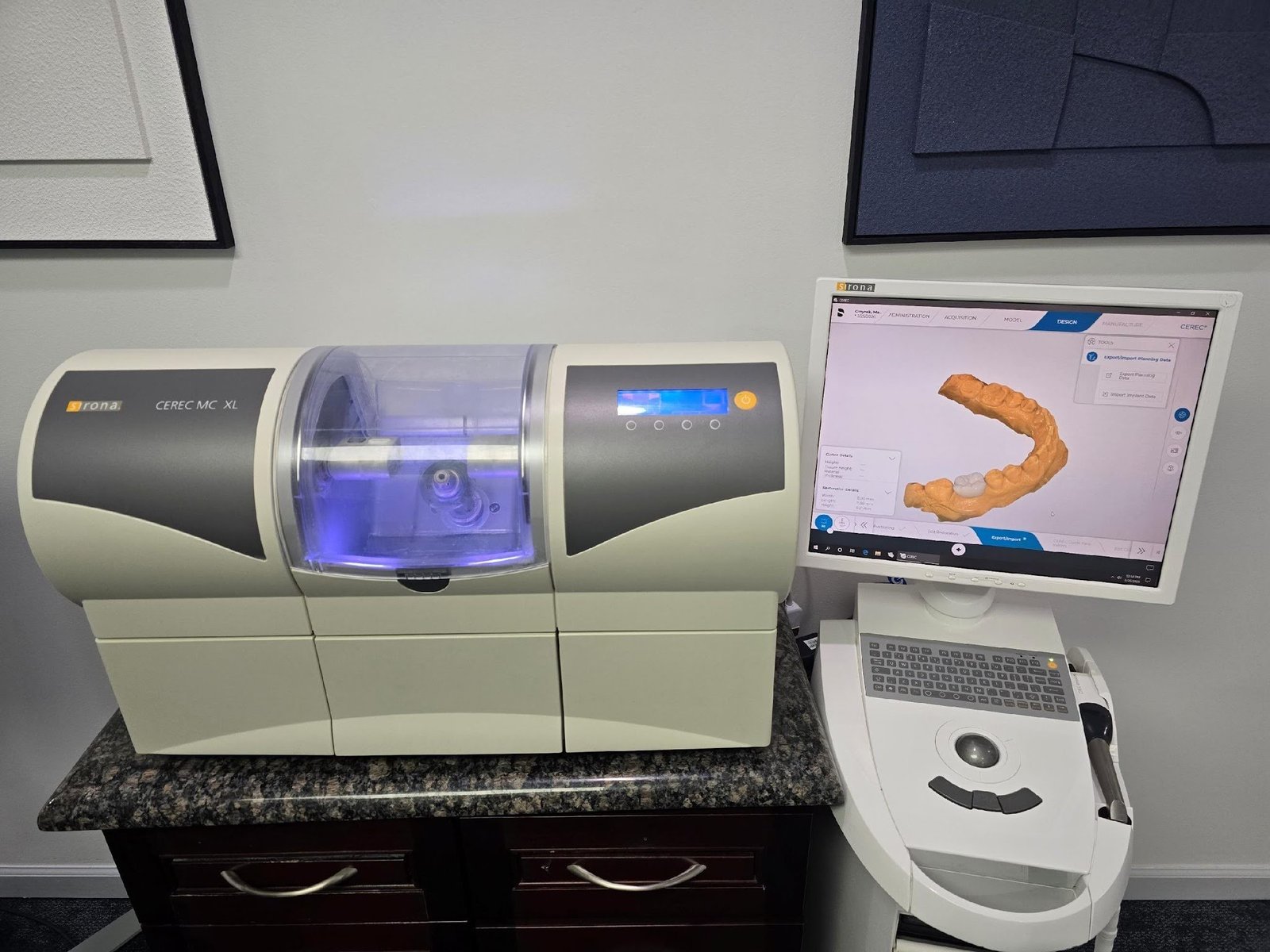 What is CEREC